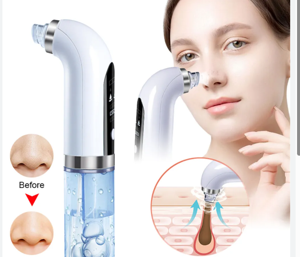 extractor de espinillas a vapor